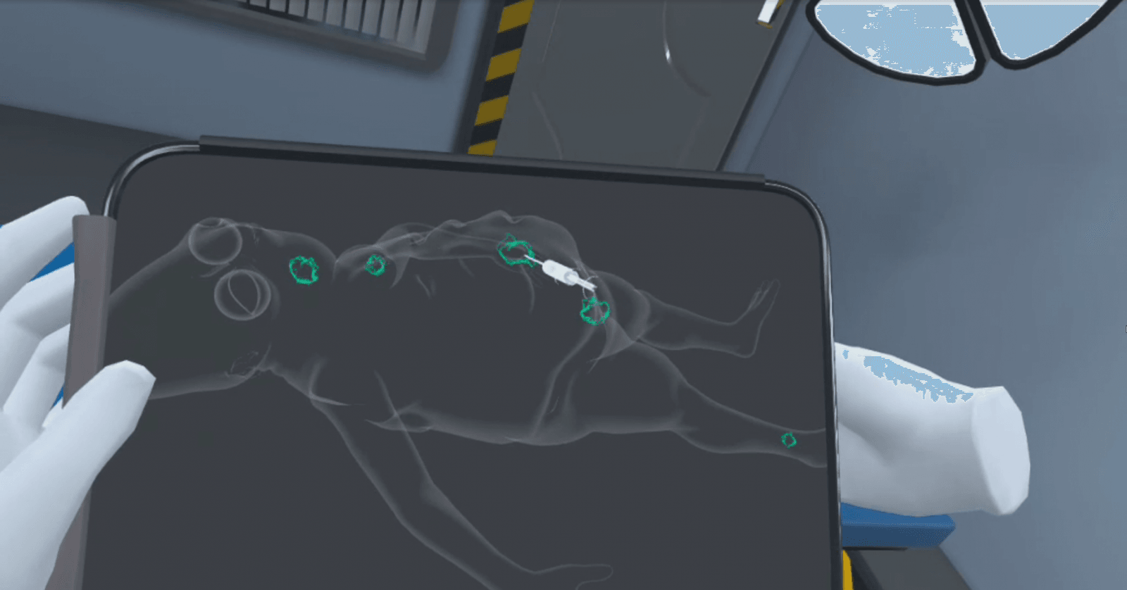 Table Tumors — screenshot 2 of 3